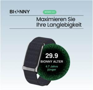 Bionny 4.0 Recensione: Perché 50.000 Persone Hanno Scelto Questo Braccialetto a 159€ (Senza Mai Pagare un Abbonamento)